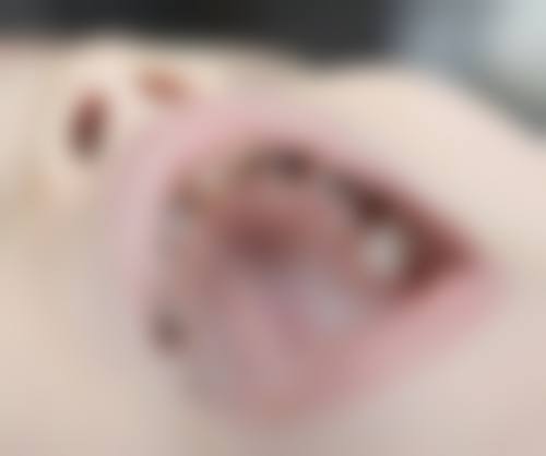 【开封优博雅口腔门诊部骨干医生团队与技术标准】