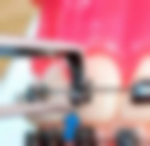 【开封优博雅口腔门诊部参考价格表】