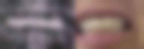 【渭南临渭贝壳口腔门诊部前列技术设备与院感环境】