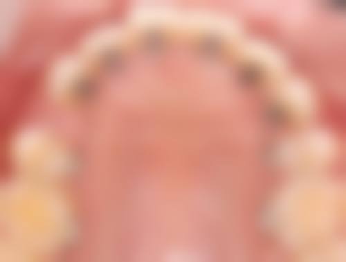 【渭南临渭贝壳口腔门诊部特色诊疗项目】
