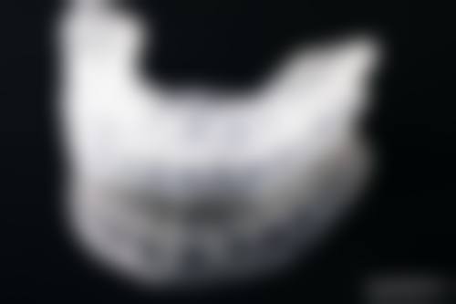 【中卫至美口腔特色诊疗项目】