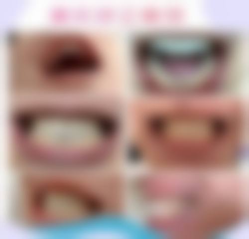 【中卫至美口腔预约挂号方式与流程】