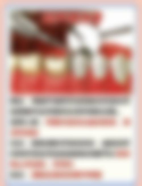 【湖南长沙迈尔思口腔特色诊疗项目】