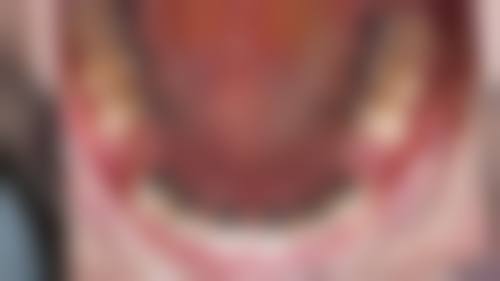 【晋中中诺口腔医院真实口碑评价】