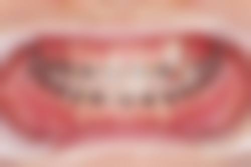 【无锡佳士洁口腔(新吴店)预约挂号方式与流程】