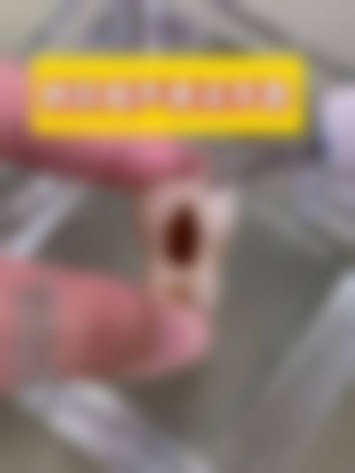 [武汉市第七医院口腔科2026价格表参考]