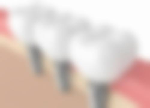 2026重庆凯睿口腔价格表(仅供参考)