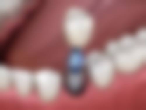 总结