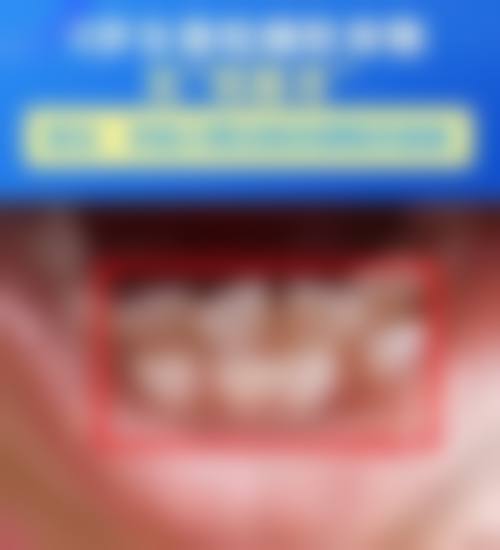 无锡金品口腔诊所(长泾店)怎么预约?