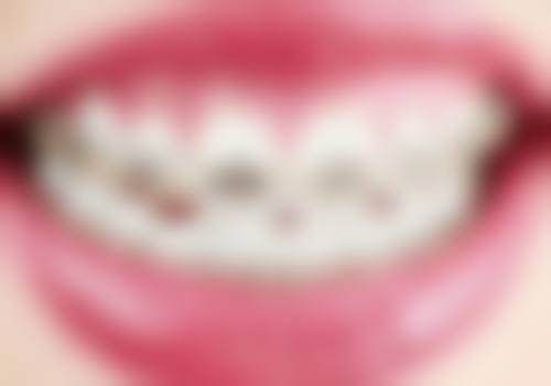 广东中山李晓艳口腔常见问题FAQ