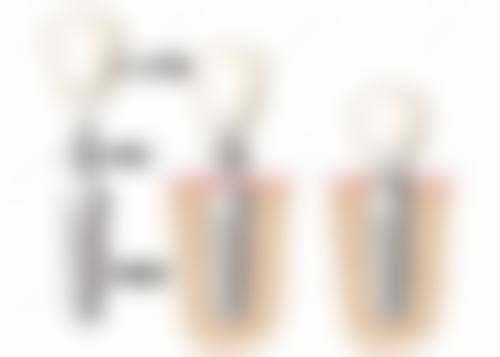 总结