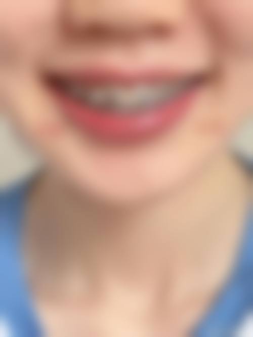 总结