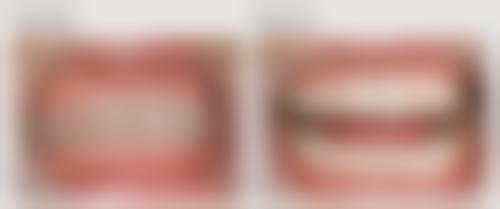 海南省中医院口腔科常见问题FAQ