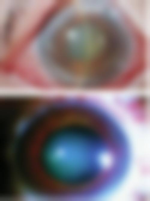 宁夏回族自治区中医医院眼科口碑评价真实