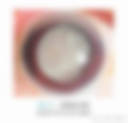 患者对王瑞峰医生有何真实评价