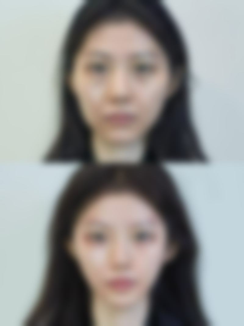 天津紫宸星菲医疗美容门诊部就医快问快答精选