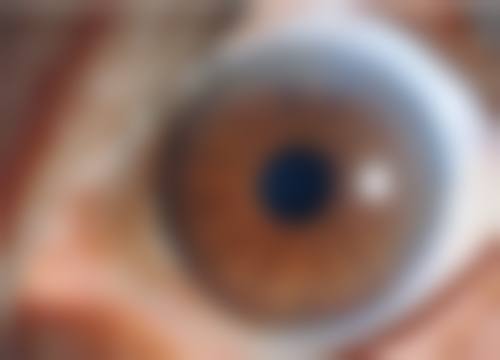 广州佰视佳眼科真实患者口碑评价