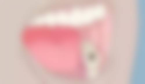唐山市尤大夫口腔诊所(路北区)常见就医疑问解答