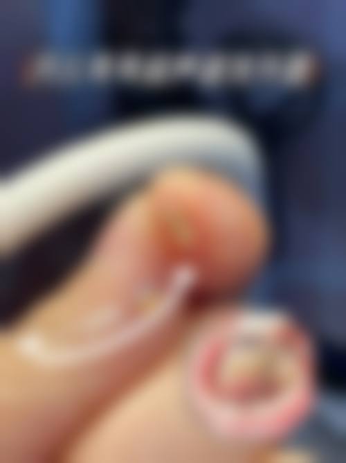 2026潍坊青州路文娜口腔诊所价格表(仅供参考)