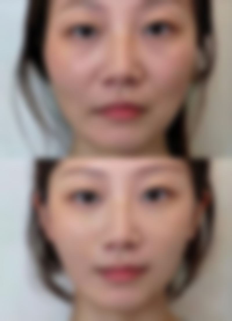 泰安市第一人民医院美容整形外科中 心预约方式便捷