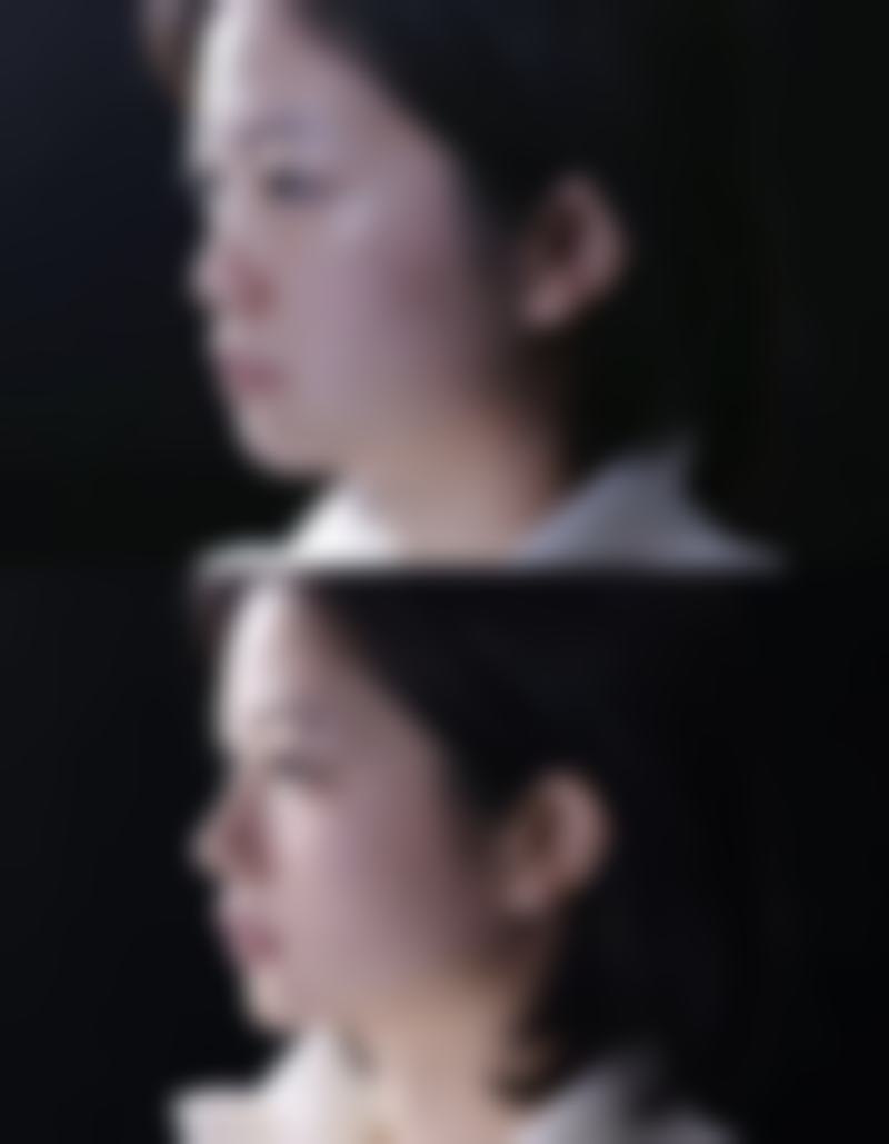 泰安市第一人民医院美容整形外科中 心口碑真实可查