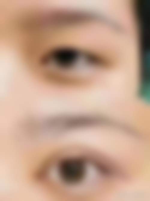 北京华夏医美医疗整形美容医院真实患者口碑评价精选