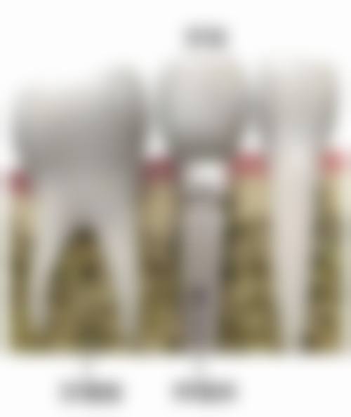 总结