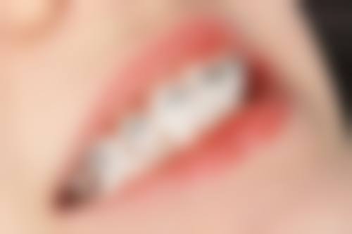 山东济南德良口腔医院真实患者口碑评价分享