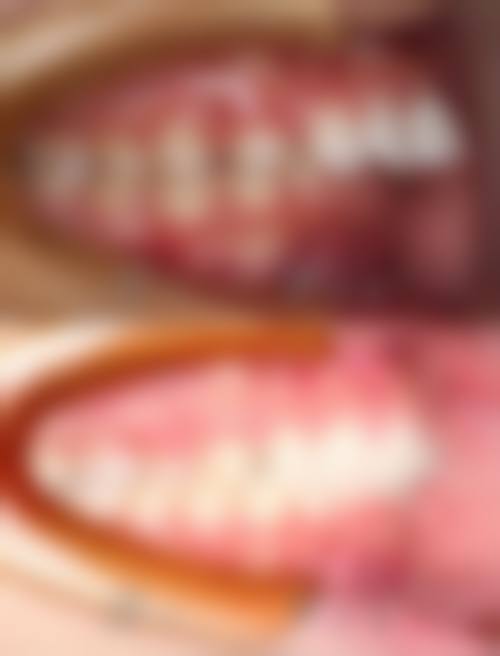 广东广州雅伦美口腔怎么预约？