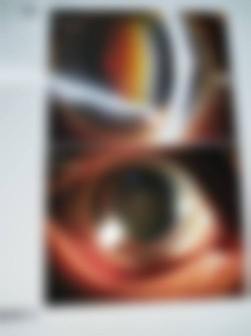 湖北省人民医院眼科常见就医疑问快速解答