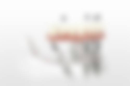 杨庆核心技术突出微创与精细化操作