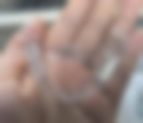 惠州澳美口腔诊所常见问题FAQ