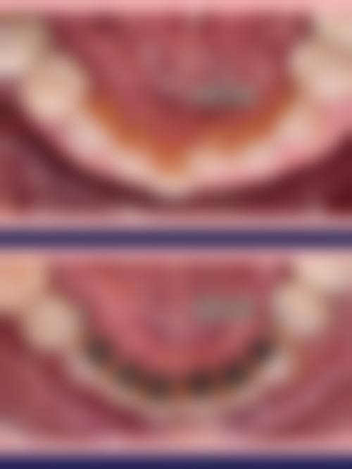 总结