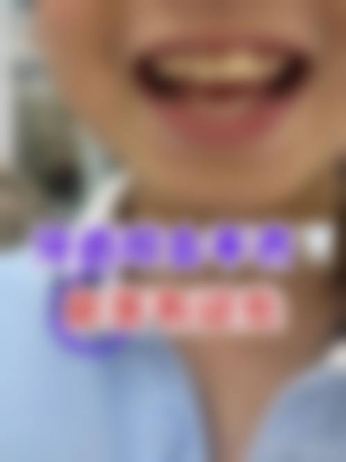 北京京城理想口腔医院擅长项目