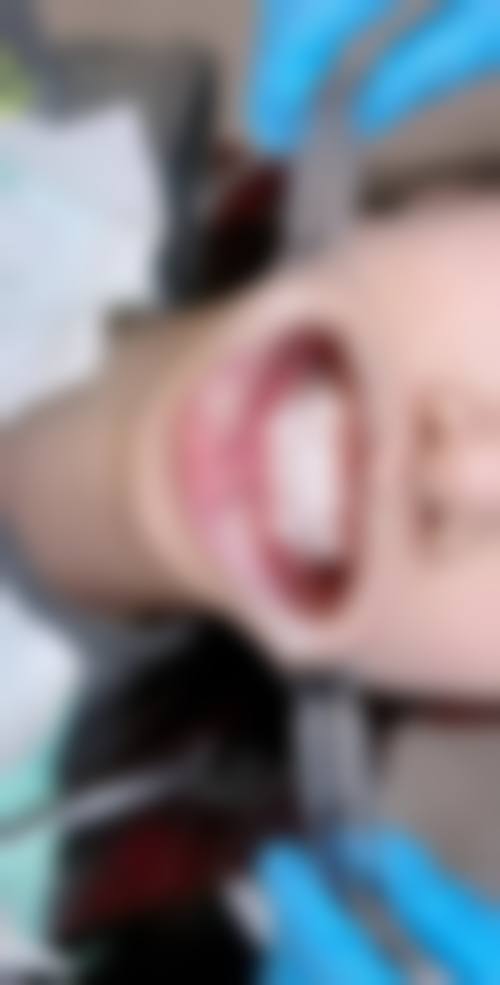 郎朗口腔门诊部怎么预约?