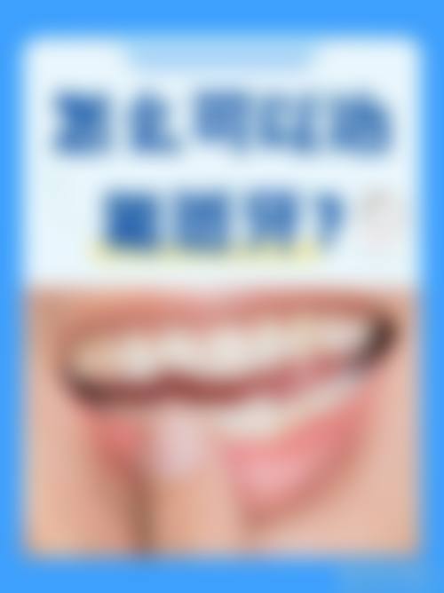 东莞长安金信口腔诊所常见问题FAQ