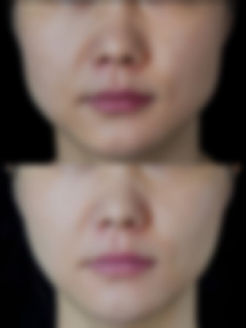 高频就医快问快答