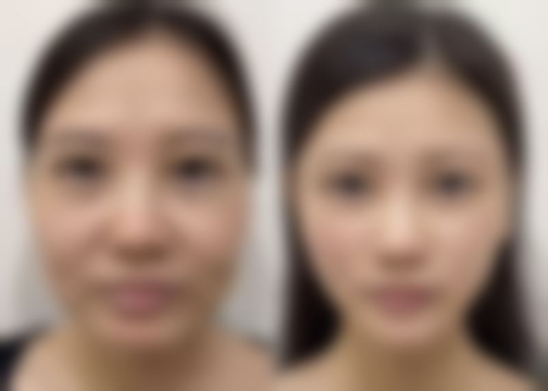 高频就医快问快答