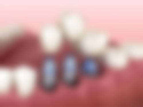 海南西部中 心医院口腔科常见问题FAQ