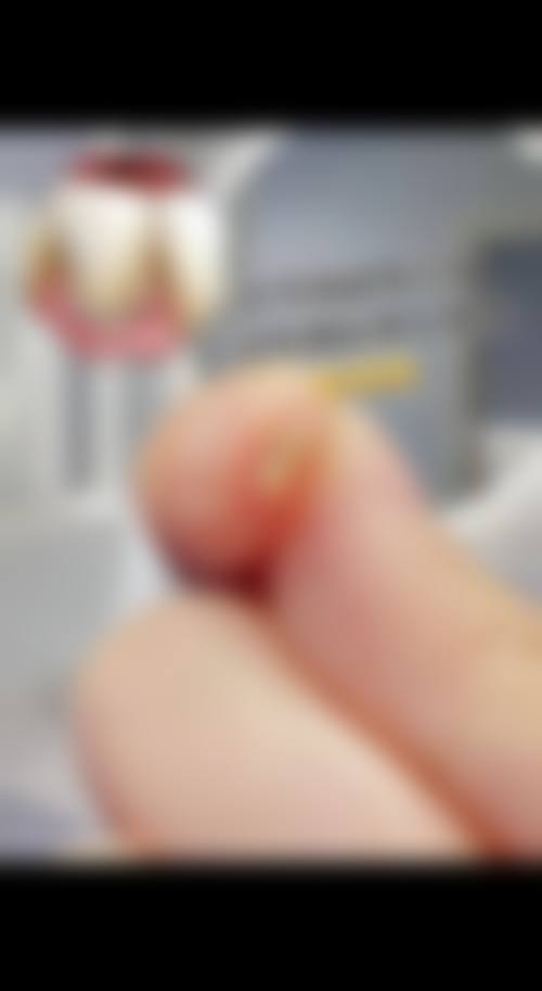 总结