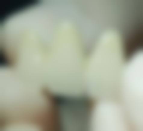 总结
