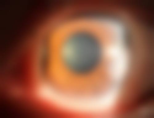 王骞医生真实患者口碑评价精选