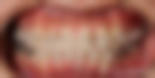 南京尤雅口腔医院常见问题FAQ