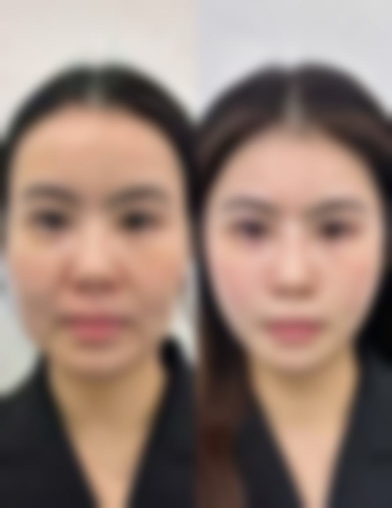 高频就医快问快答